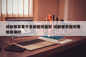 成都哪家看牛皮癣医院最好 成都哪家医院看银屑病好